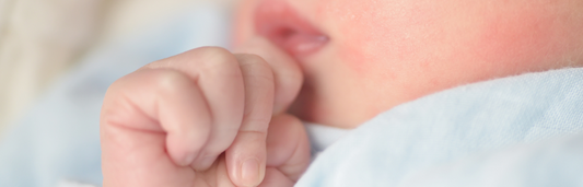 Alergia en bebés: síntomas y causas
