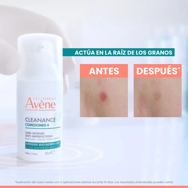 Avène Cleanance Comedomed+ , 30 ml