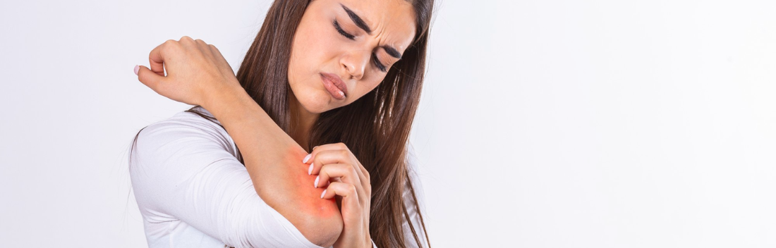 Cómo cuidar la piel atópica y mantenerla hidratada y protegida a diario