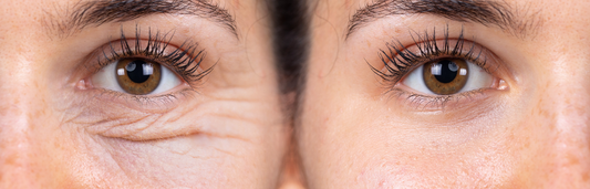 Cómo estimular la producción de colágeno y mejorar la firmeza y elasticidad de la piel