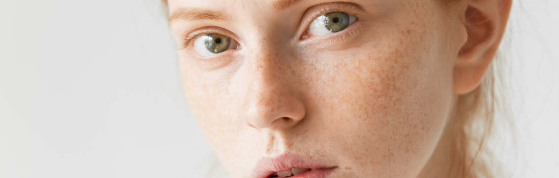 Conoce Neoretin Discrom, el mejor serum para tratar las manchas