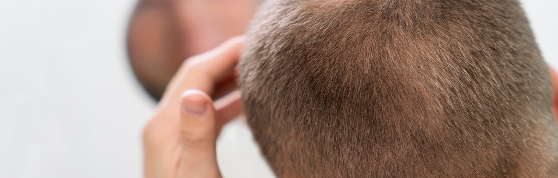Los mejores tratamientos anticaída para el cabello y cómo ayudan a fortalecerlo