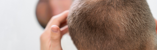Los mejores tratamientos anticaída para el cabello y cómo ayudan a fortalecerlo