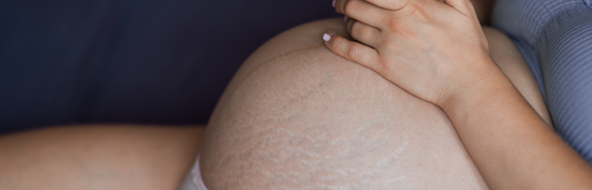 Cómo prevenir la aparición de estrías durante el embarazo