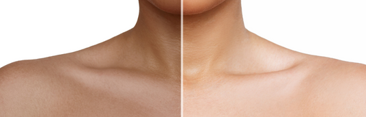 Cómo broncear tu piel sin salir de casa