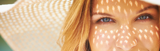 Protégete del Sol este verano