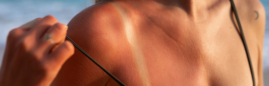 Consejos para preparar, proteger y reponer nuestra piel después del sol