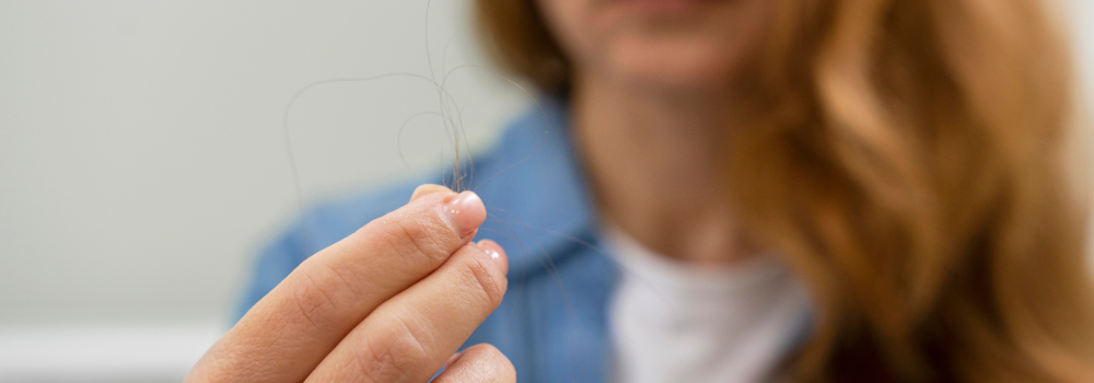Caída del pelo después del verano: consejos y tratamientos de farmacia
