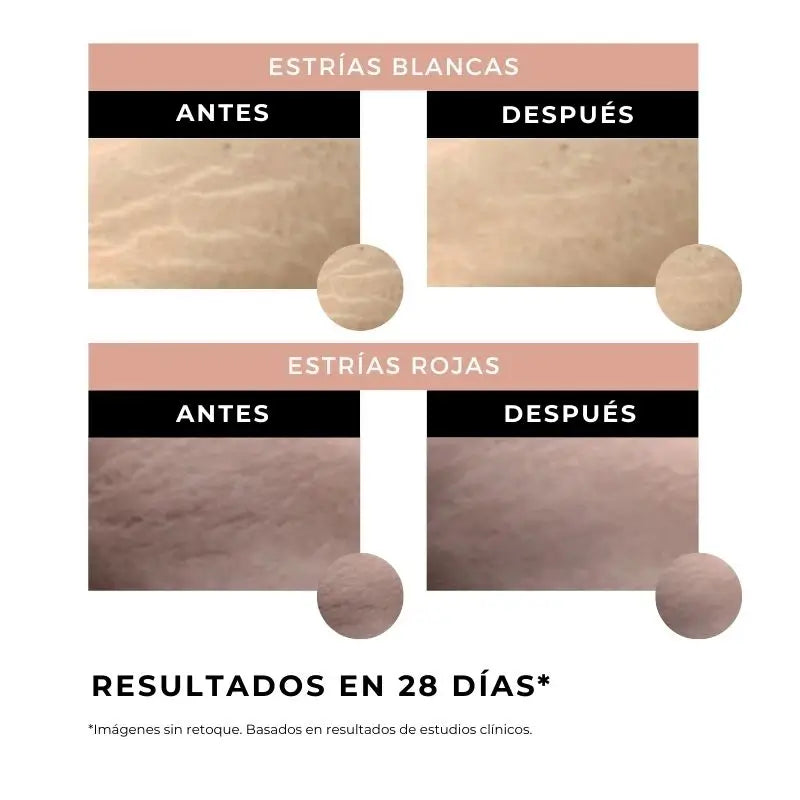 Arganour Corporal Crema Antiestrías, 100 Ml