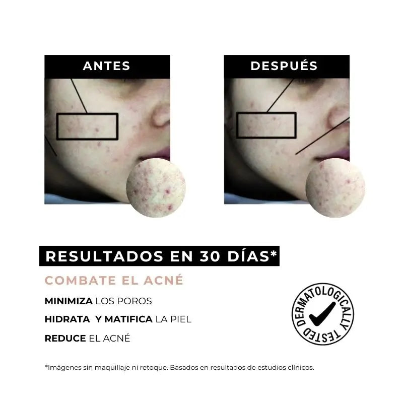 Arganour Facial Equilibrium Crema Antiacné, 50 Ml