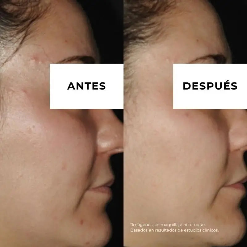 Arganour Facial Equilibrium Crema Antiacné, 50 Ml