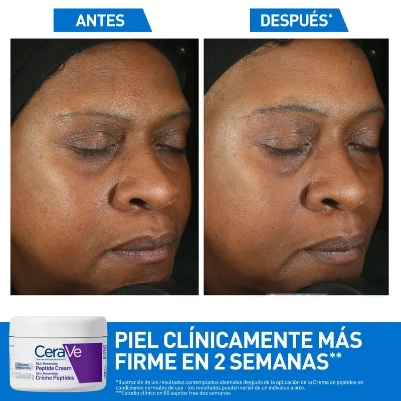 Cerave Skin Renewing Crema Con Péptidos , 48 ml
