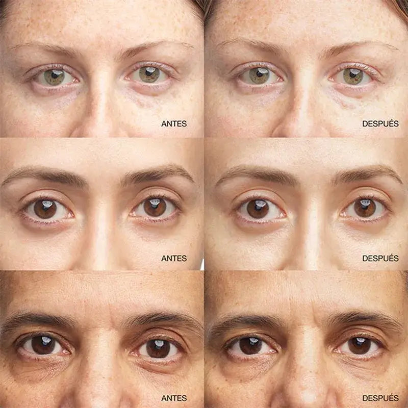 Clinique All About Eyes Sérum Concentrado Iluminador Contorno De Ojos, 10 ml