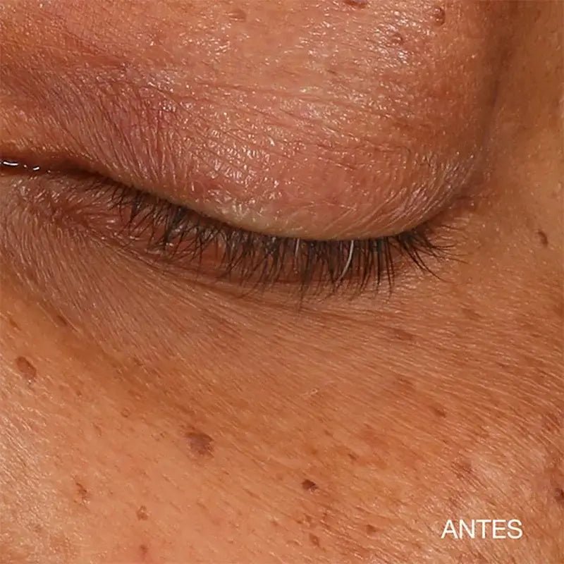 Clinique All About Eyes Sérum Concentrado Iluminador Contorno De Ojos, 10 ml