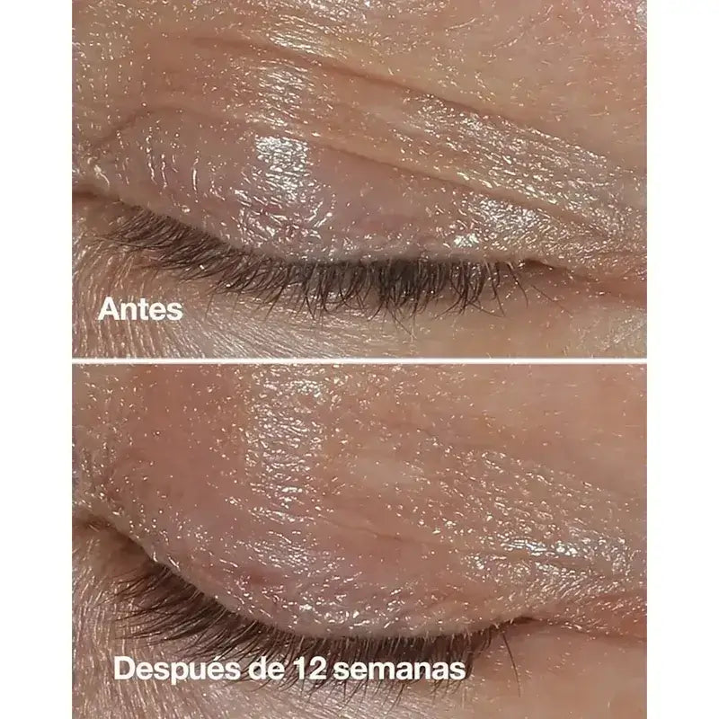 Clinique Smart Clinical Repair Crema de Contorno de Ojos de Corrección Antiarrugas, 2x15 ml