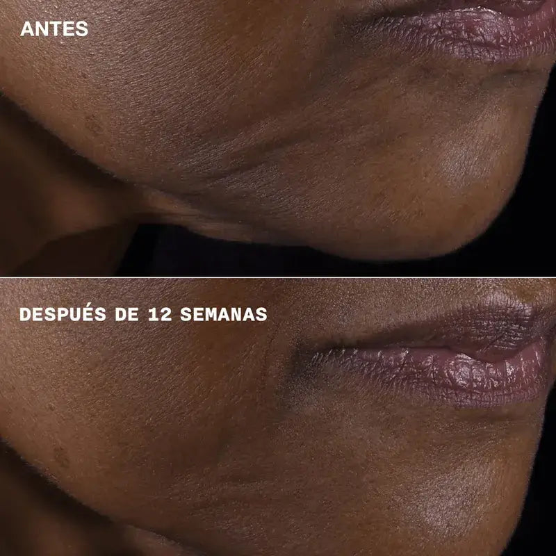 Clinique Smart Clinical Repair Rostro y Cuello Antiedad, 50 ml