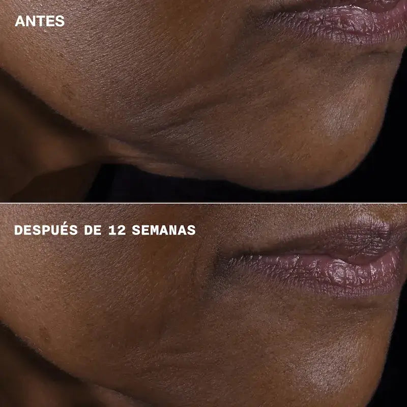 Clinique Smart Clinical Repair Firmeza + Lifting para Rostro y Cuello, 75 ml