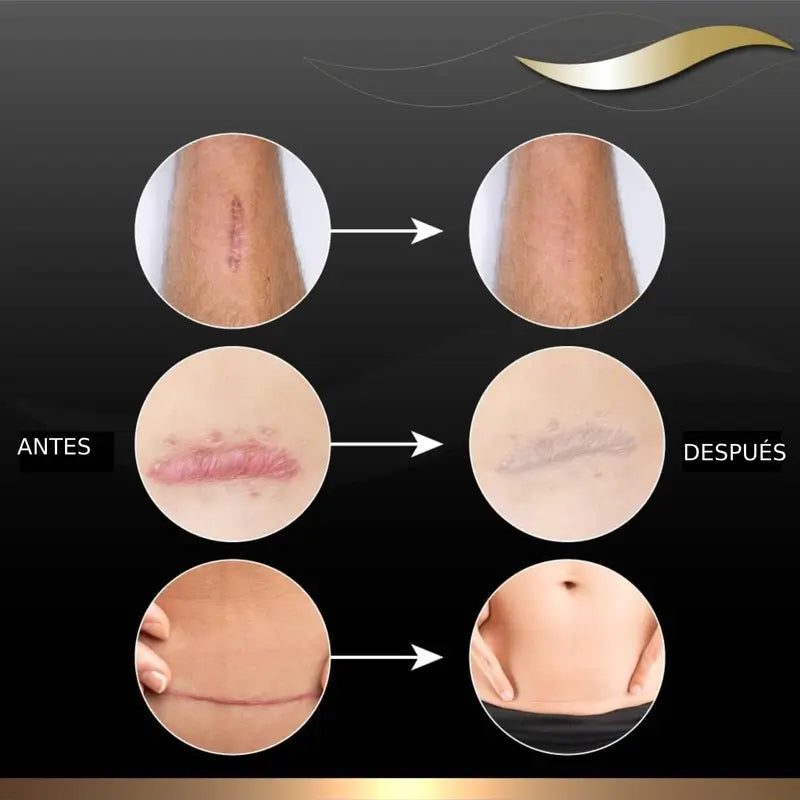 Dermatix Gel Silicona Tratamiento de Cicatrices, 15g