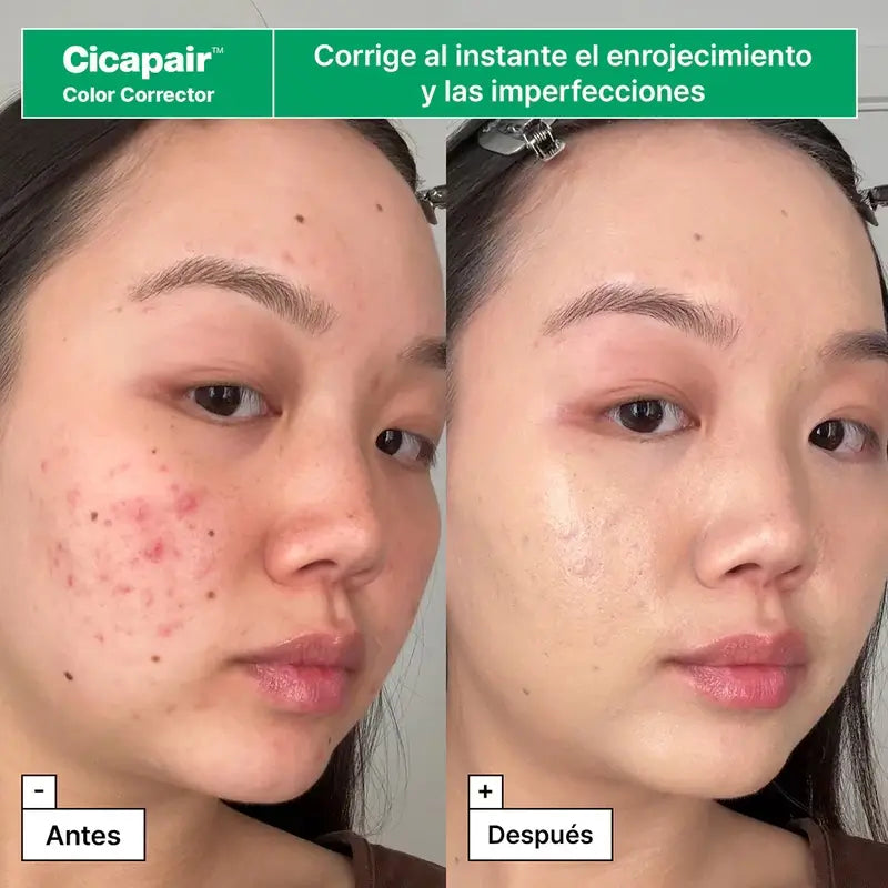 Dr.Jart+ Kit De Rescate Para Piel Con Enrojecimiento Con Centella Asiática