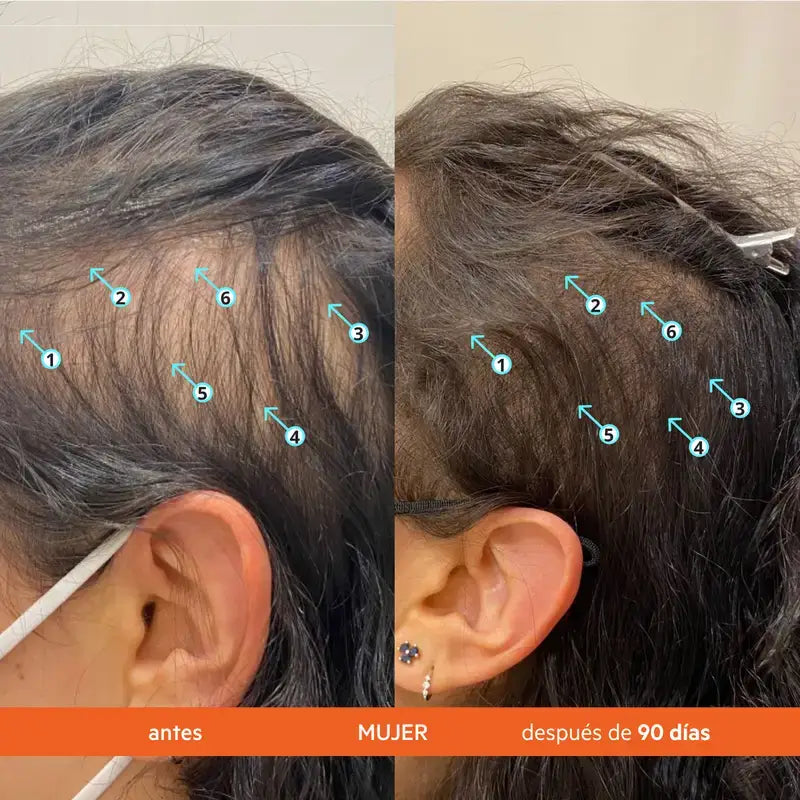 Ds Laboratories Revita Acondicionador Anticaída Estimulante Del Cabello, 925 ml