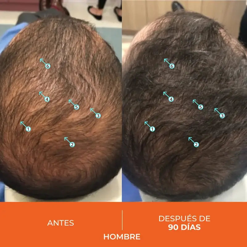 Ds Laboratories Revita Comprimidos Anticaída, 30 uds