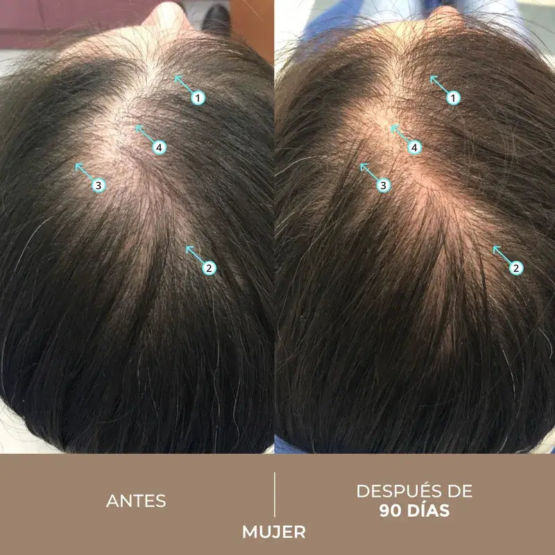 Ds Laboratories Spectral Loción Spectral Dnc-N Tratamiento Con Nanoxidil® 5% Contra La Caída Del Cabello, 60 ml