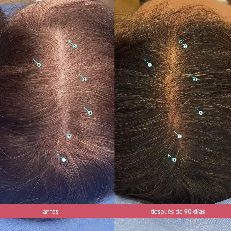 DS Laboratories Spectral Women's Sérum Para La Densidad Capilar, 60ml