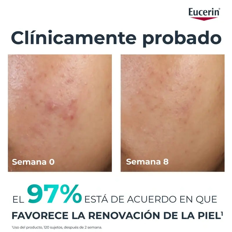 Eucerin Dermopure Peeling 10% Hidroxiácidos, 40 ml