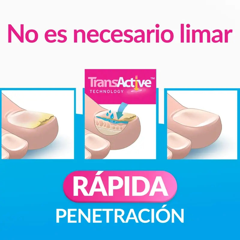 Excilor Esmalte Tratamiento de la Micosis de las Uñas, 3,3 ml