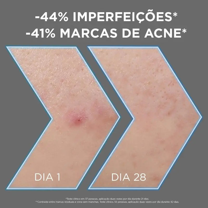 Garnier Serum Anti-Imperfecciones Con 4% Niacinamida, Aha Y Bha, 30Ml