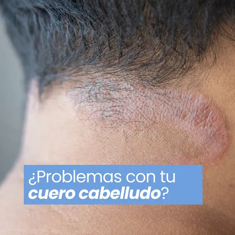 Green Cornerss Champú de Gisante, 300 ml