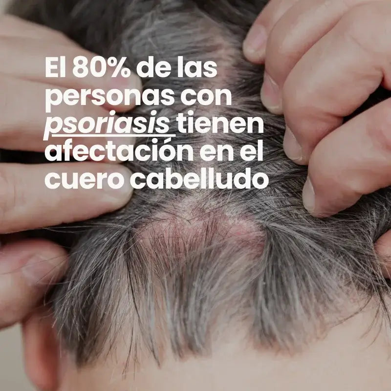 Green Cornerss Champú de Gisante, 300 ml