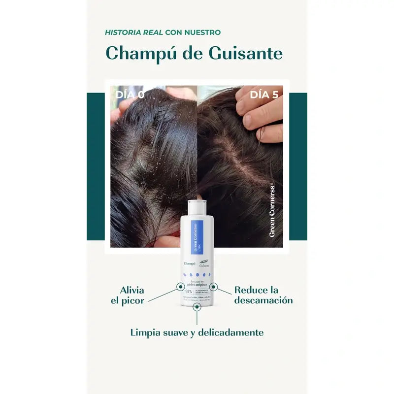 Green Cornerss Champú de Gisante, 300 ml