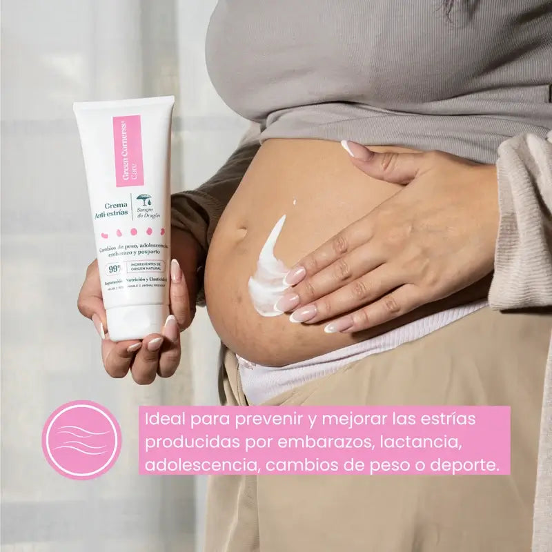 Green Cornerss Crema Anti-estrías de Sangre de Dragón, 200 ml