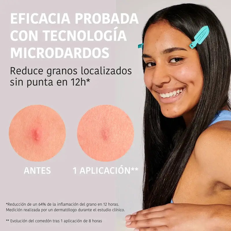 Iroha Nature Acne Prone Skin Parches Granos Microdardos, 12 unidades