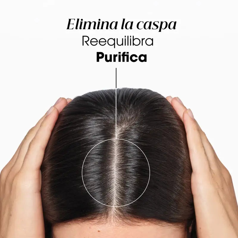 Klorane Champú Anticaspa Tratante Reequilibrante A La Galanga, 400 ml