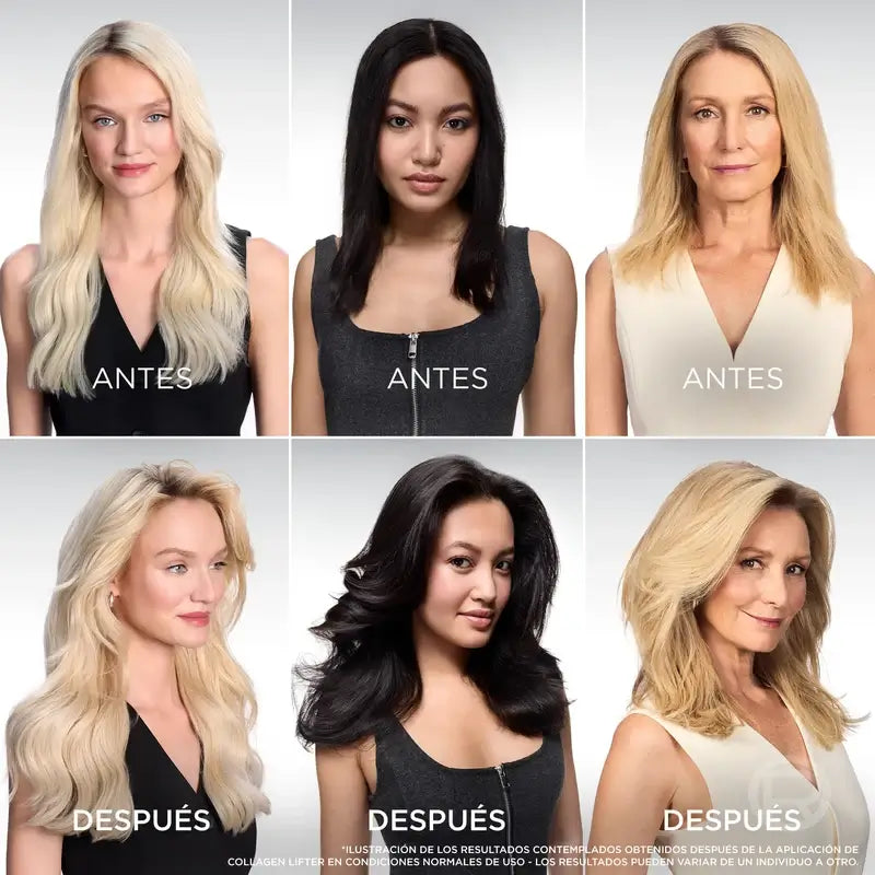 L'Oréal Paris Elvive, Champú Voluminizador Con Péptidos De Colágeno, 400 ml