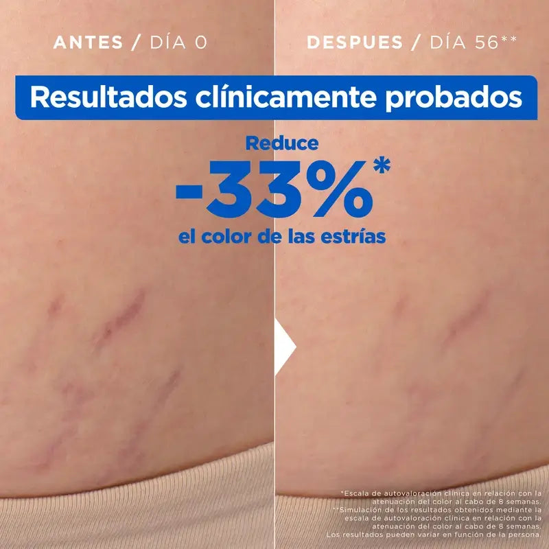 Mixa Aceite Antiestrías, 100 ml