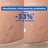 Mixa Aceite Antiestrías, 100 ml
