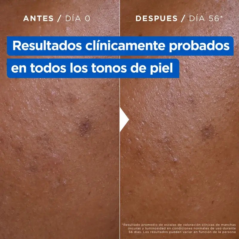 Mixa Niacinamida Crema Antimanchas , 400 ml