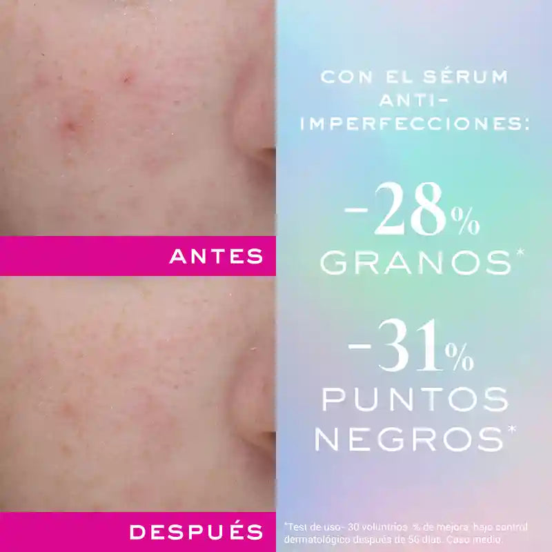 Nuxe Zinc Power Sérum Anti-Imperfecciones , 30 ml