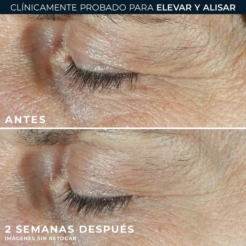 Roc Skincare Iberia Roc® Derm Correxion® Dual Eye 20Ml