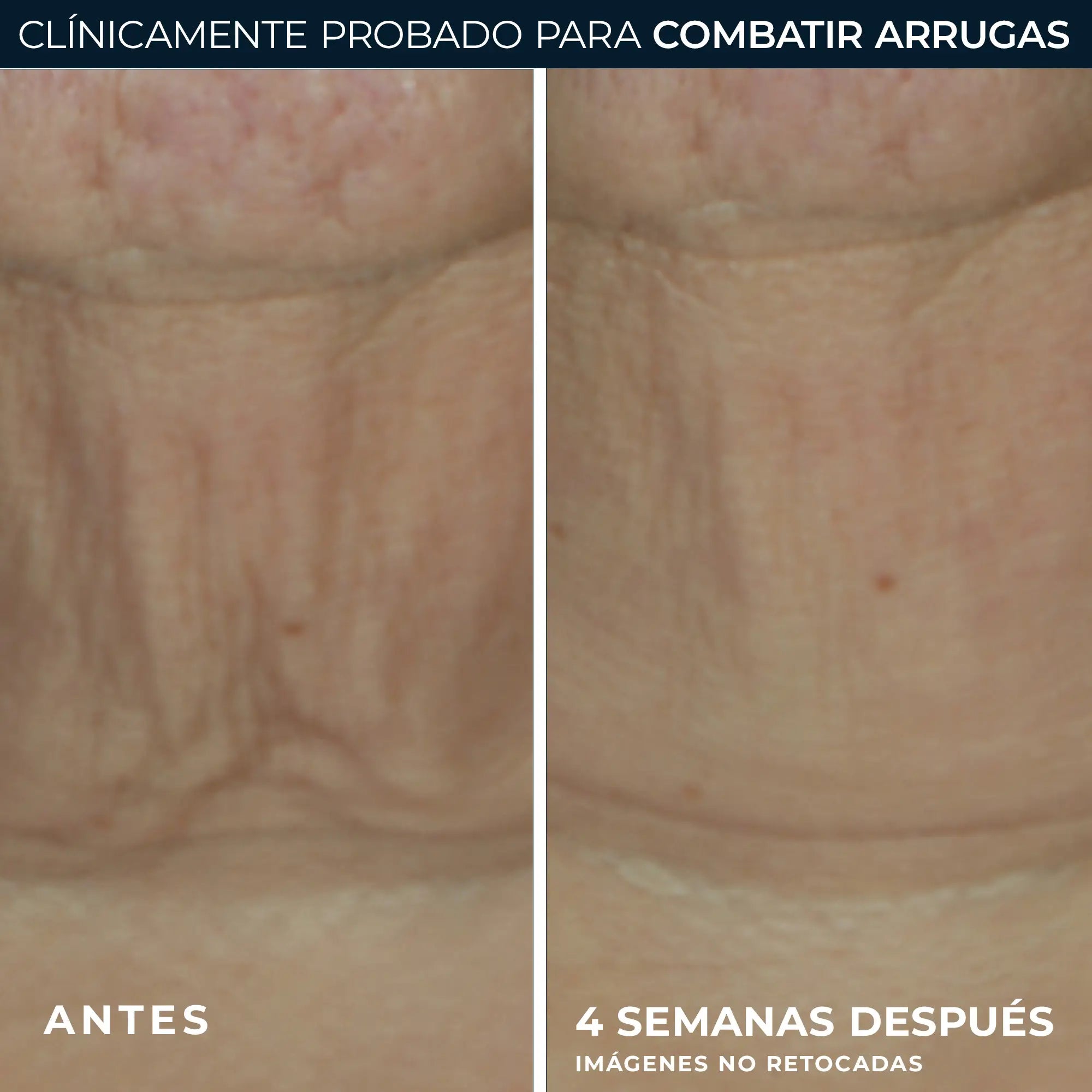 Roc Skincare Iberia Roc® Derm Correxion® Firming Stick 30G