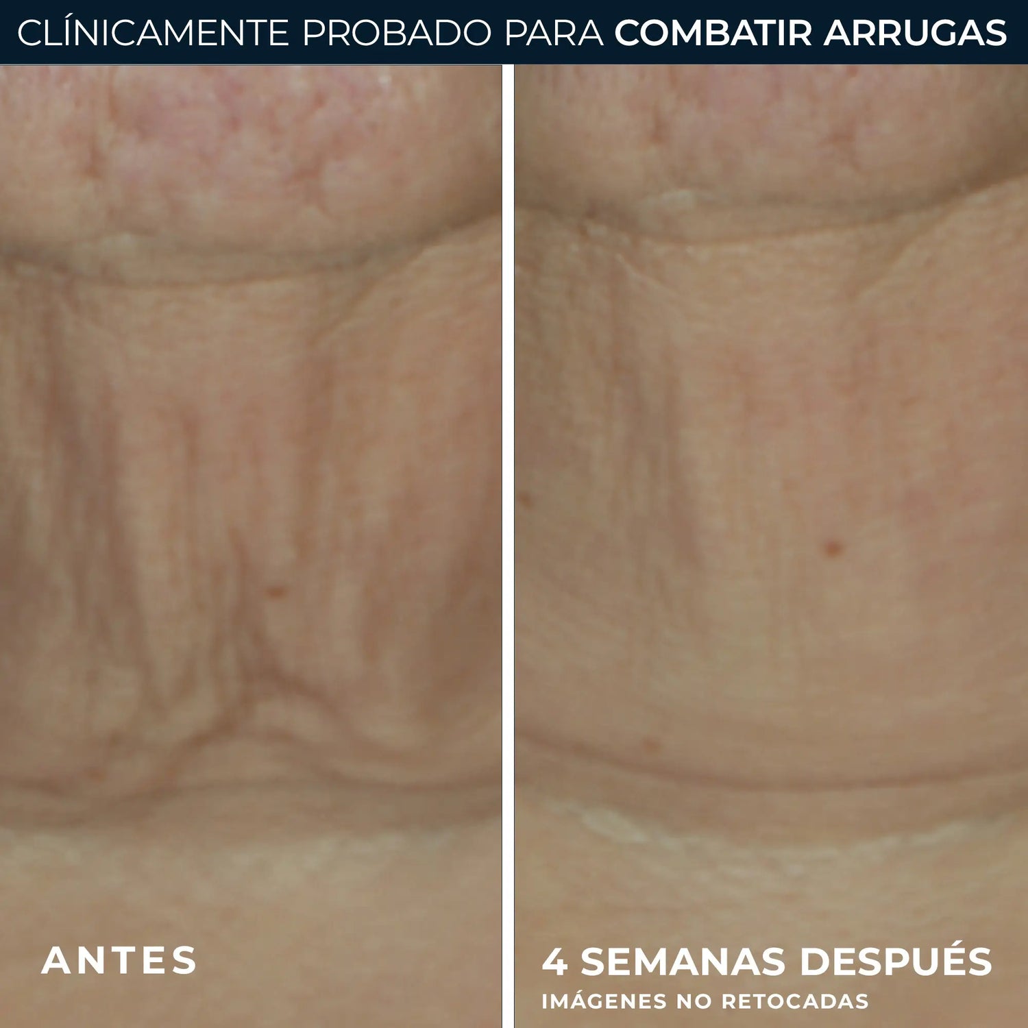 Roc Skincare Iberia Roc® Derm Correxion® Firming Stick 30G