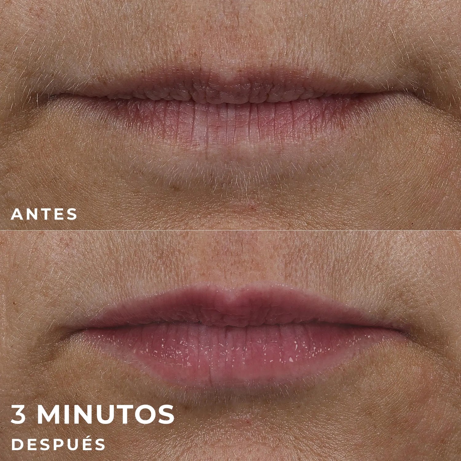 Roc Skincare Iberia Roc® Derm Correxion® Lip Volumizer 10Ml