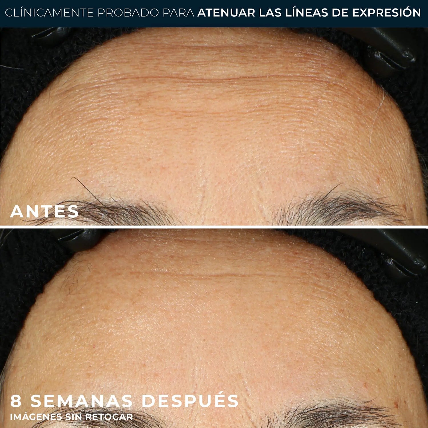 Roc Skincare Iberia Roc® Line Smoothing Sérum En Cápsulas 30Uds