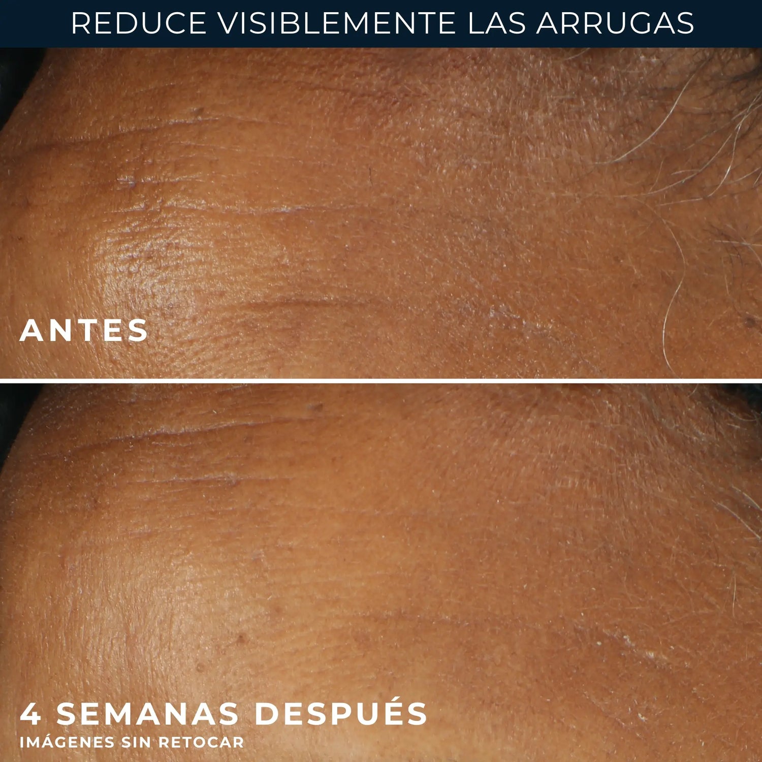 Roc Skincare Iberia Roc® Wrinkle Correct Crema Día Spf30 30Ml
