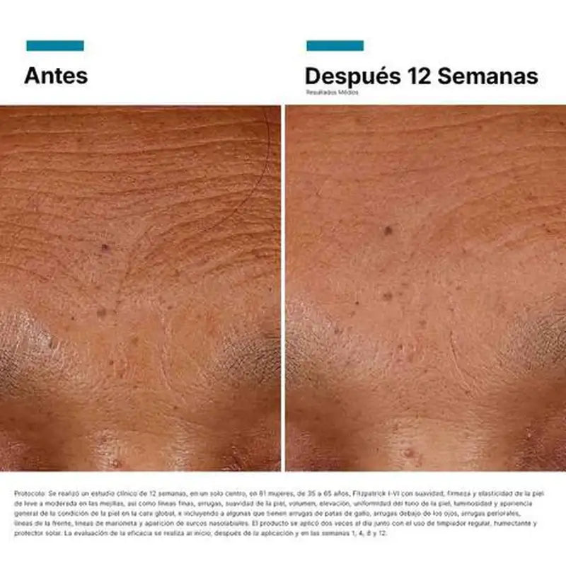 Skinceuticals Hyaluronic Acid Intensifier Multi-Gly Serum, 30 ml