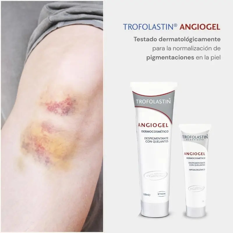 Trofolastin Angiogel Crema Despigmentante, 2x100 ml