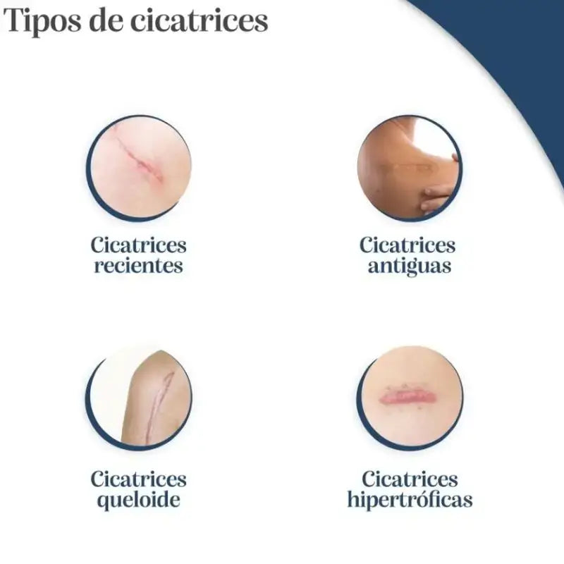 Trofolastin Reductor De Cicatrices, Pack 2 x 10X14 Cm